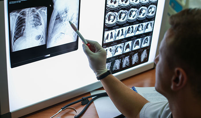 The 4 Stages of COPD and Why Early Detection Helps